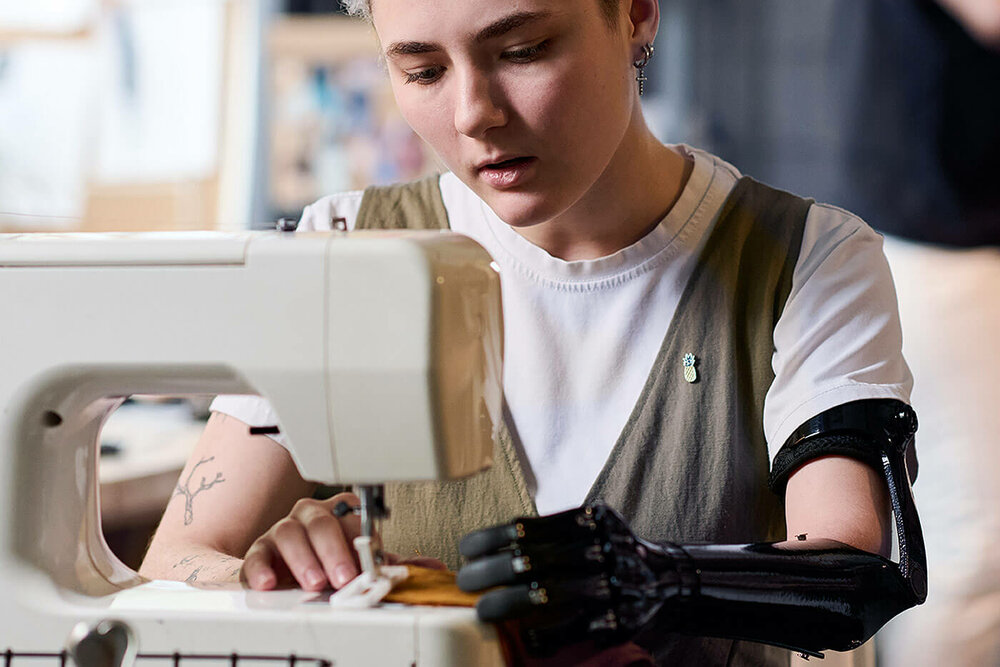 Eine junge Frau mit einer Armprothese sitzt an einer Nähmaschine.